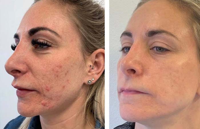 Pain Relief Vacaville CA Before And After